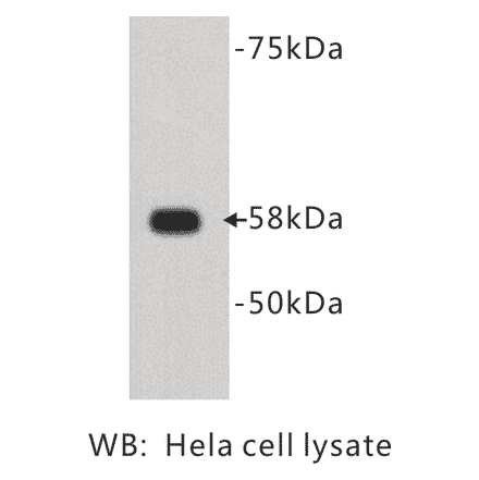 Western Blot - Anti-Alkaline Phosphatase Antibody (BMA1004) - Antibodies.com