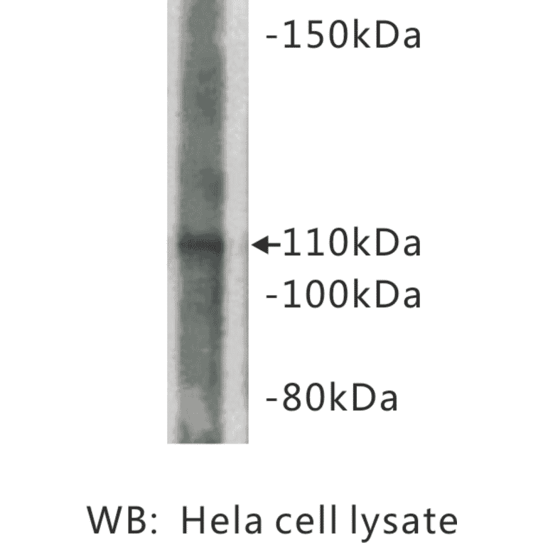 Western Blot - Anti-Amyloid beta A4 Precursor Antibody (BMA1005) - Antibodies.com