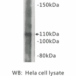 Western Blot - Anti-Amyloid beta A4 Precursor Antibody (BMA1005) - Antibodies.com