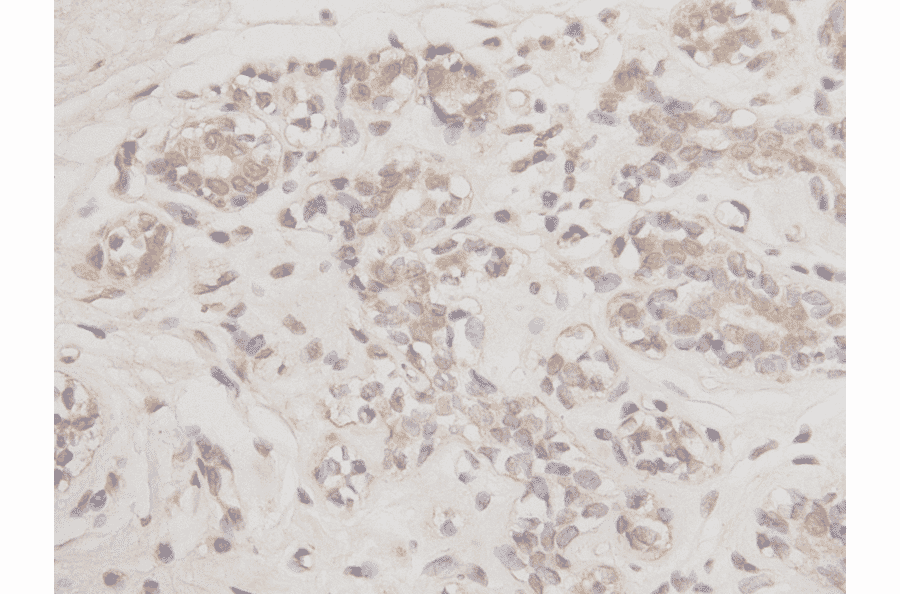 Immunohistochemistry - Anti-Bcl 2 Antibody (BMA1007) - Antibodies.com
