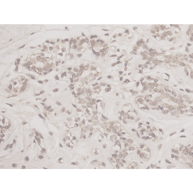 Immunohistochemistry - Anti-Bcl 2 Antibody (BMA1007) - Antibodies.com