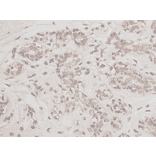 Immunohistochemistry - Anti-Bcl 2 Antibody (BMA1007) - Antibodies.com