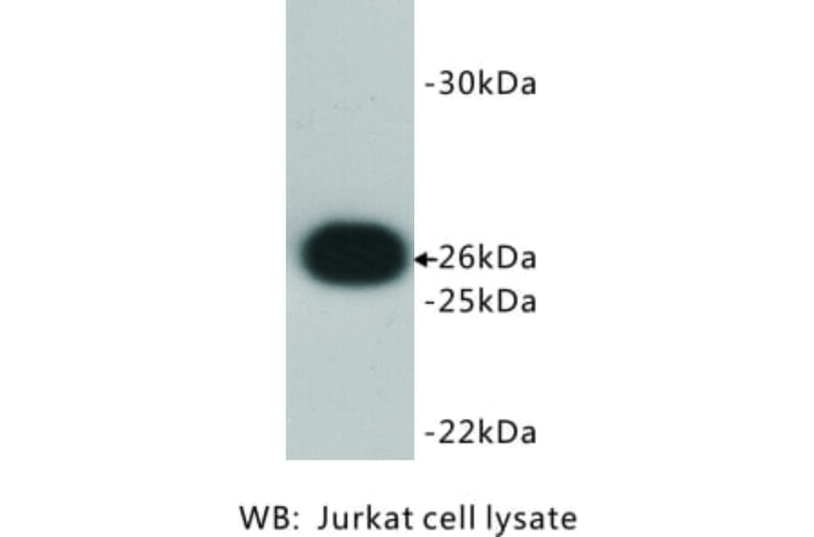 Western Blot - Anti-Bcl 2 Antibody (BMA1007) - Antibodies.com