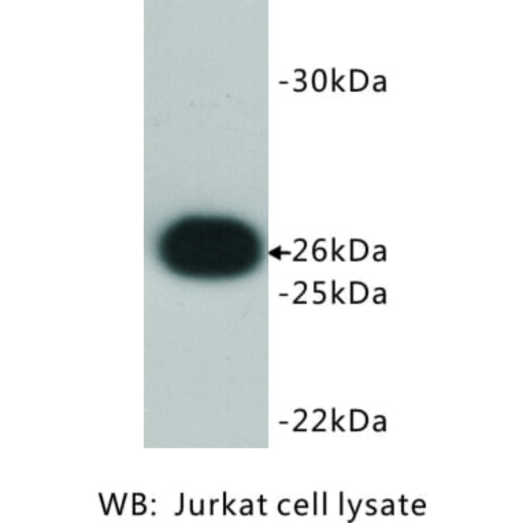 Western Blot - Anti-Bcl 2 Antibody (BMA1007) - Antibodies.com