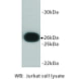 Western Blot - Anti-Bcl 2 Antibody (BMA1007) - Antibodies.com