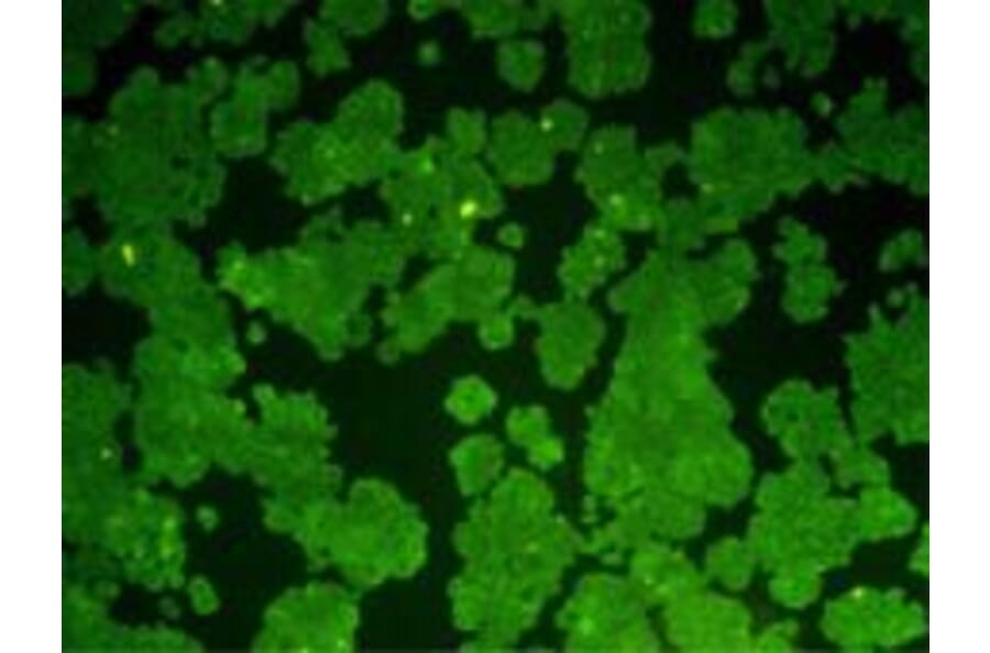 Immunocytochemistry - Anti-Bcl 2 Antibody (BMA1007) - Antibodies.com