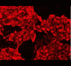 Immunocytochemistry - Anti-CIP2A Antibody (BMA1008) - Antibodies.com