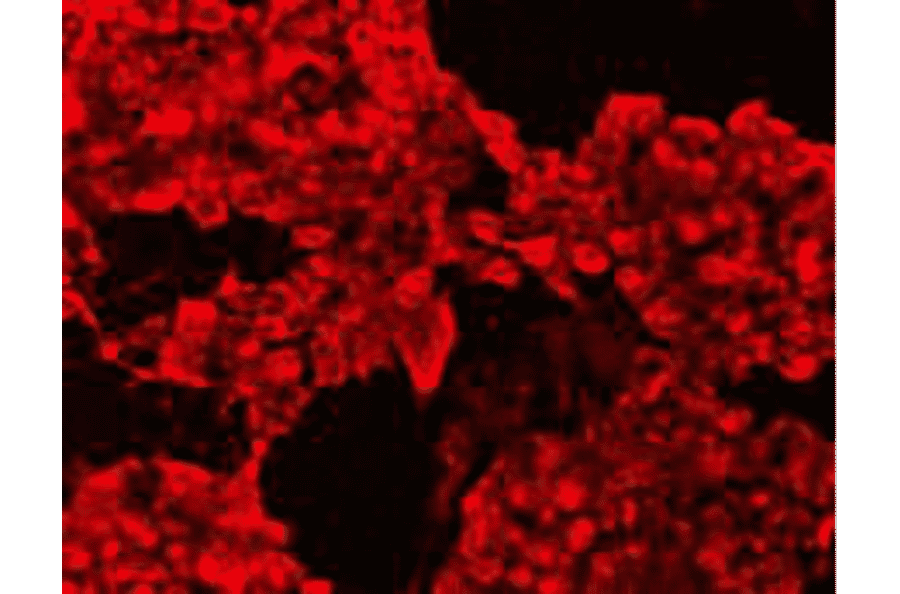 Immunocytochemistry - Anti-CIP2A Antibody (BMA1008) - Antibodies.com