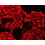 Immunocytochemistry - Anti-CIP2A Antibody (BMA1008) - Antibodies.com