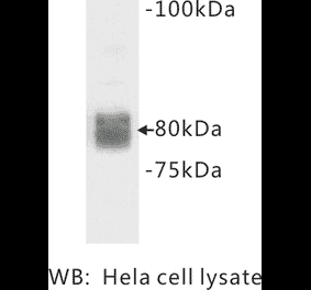 Western Blot - Anti-CD44 Antibody (BMA1010) - Antibodies.com