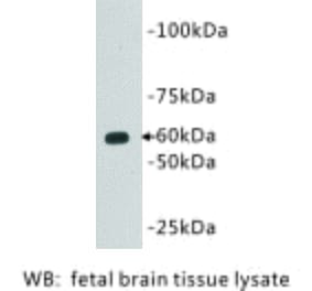 Western Blot - Anti-CD80 Antibody (BMA1011) - Antibodies.com