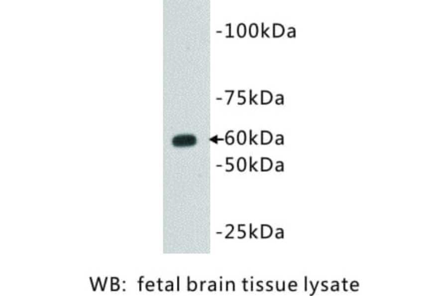 Western Blot - Anti-CD80 Antibody (BMA1011) - Antibodies.com