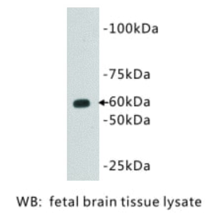 Western Blot - Anti-CD80 Antibody (BMA1011) - Antibodies.com