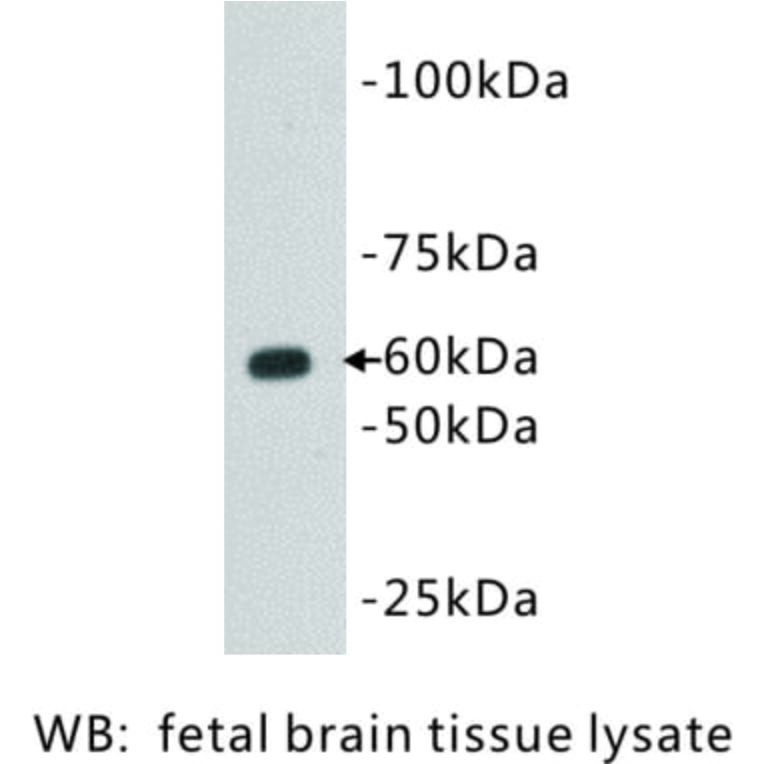 Western Blot - Anti-CD80 Antibody (BMA1011) - Antibodies.com