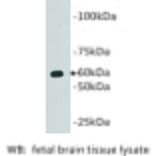 Western Blot - Anti-CD80 Antibody (BMA1011) - Antibodies.com