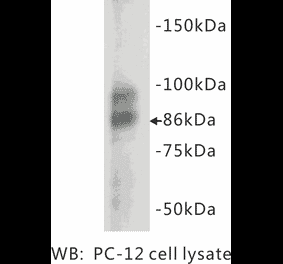 Western Blot - Anti-Chromogranin A Antibody (BMA1012) - Antibodies.com