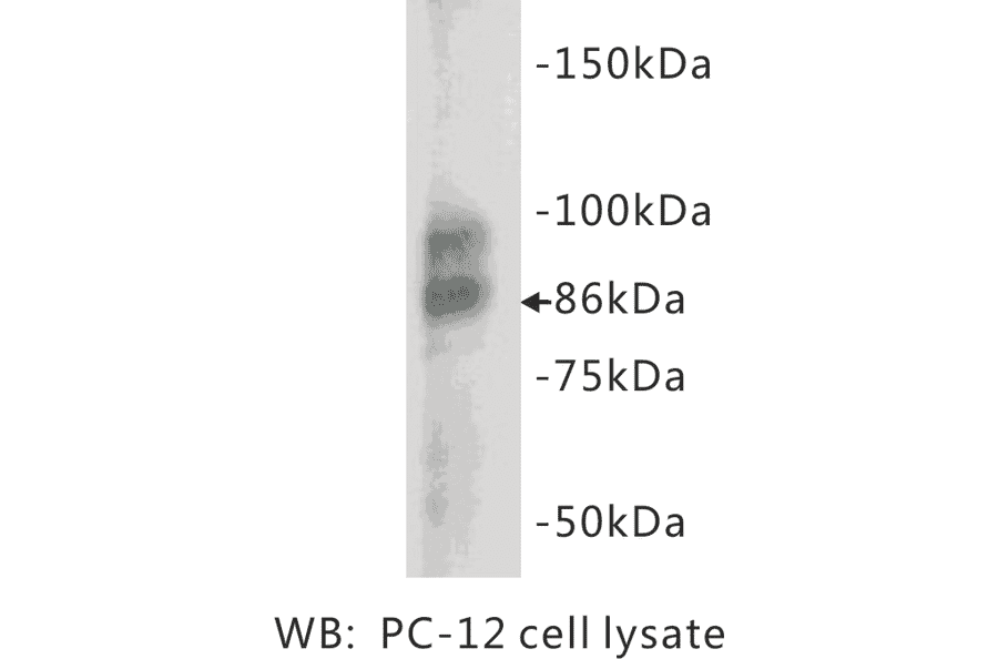 Western Blot - Anti-Chromogranin A Antibody (BMA1012) - Antibodies.com