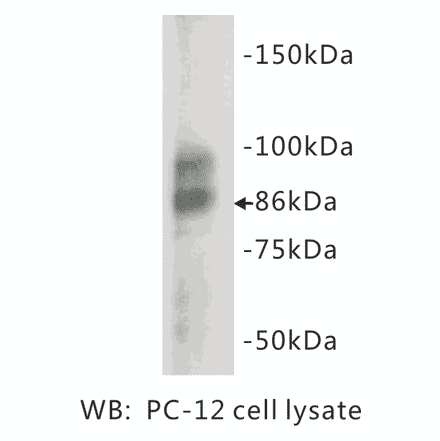 Western Blot - Anti-Chromogranin A Antibody (BMA1012) - Antibodies.com