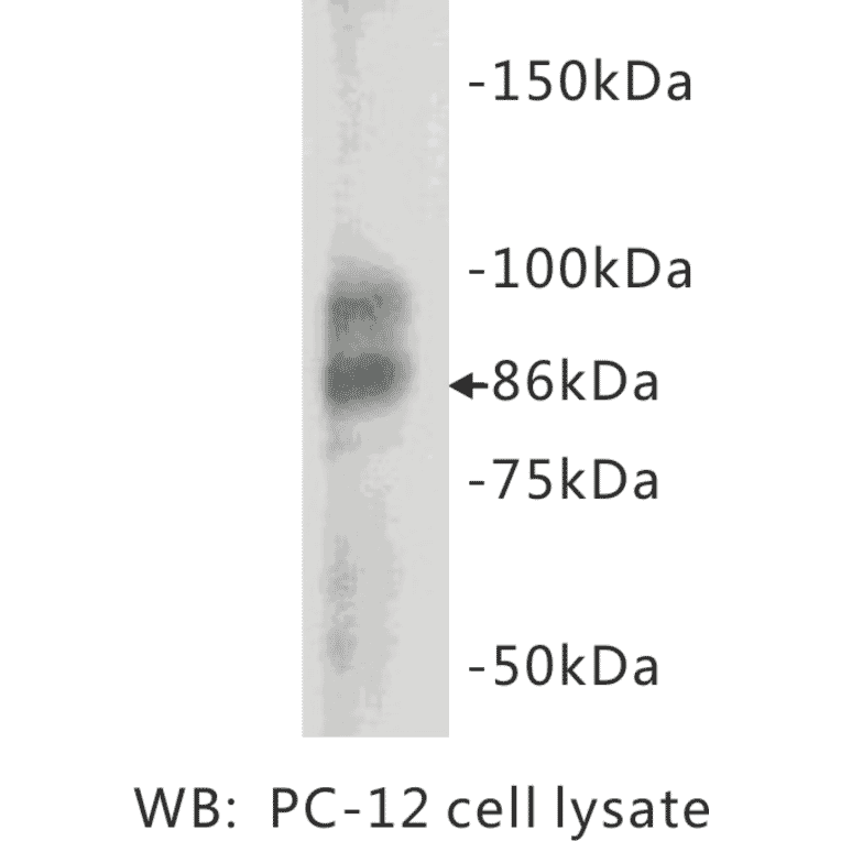 Western Blot - Anti-Chromogranin A Antibody (BMA1012) - Antibodies.com