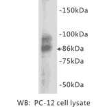 Western Blot - Anti-Chromogranin A Antibody (BMA1012) - Antibodies.com