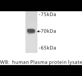 Western Blot - Anti-Complement C3 Antibody (BMA1013) - Antibodies.com