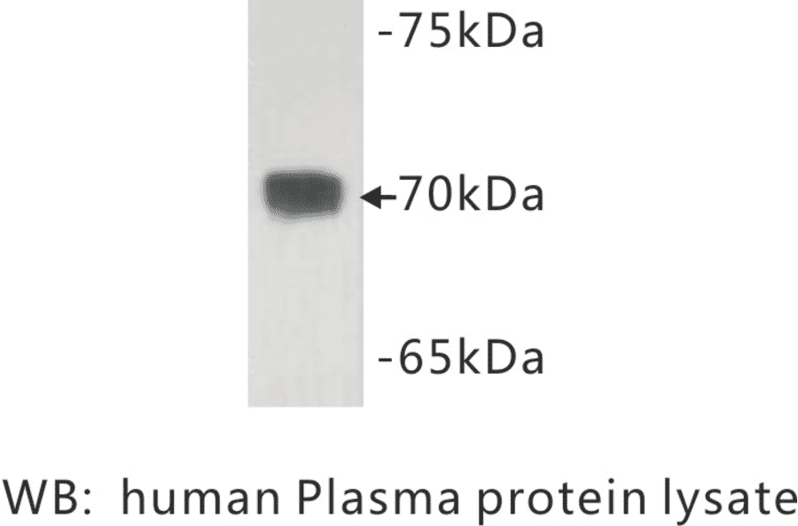 Western Blot - Anti-Complement C3 Antibody (BMA1013) - Antibodies.com