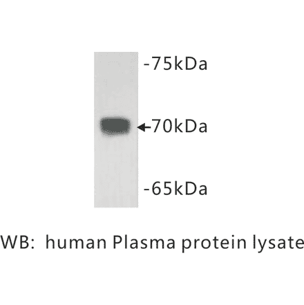 Western Blot - Anti-Complement C3 Antibody (BMA1013) - Antibodies.com