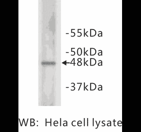 Western Blot - Anti-Cyclin E2 Antibody (BMA1014) - Antibodies.com