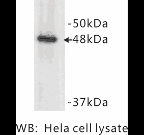 Western Blot - Anti-Cytokeratin 17 Antibody (BMA1015) - Antibodies.com