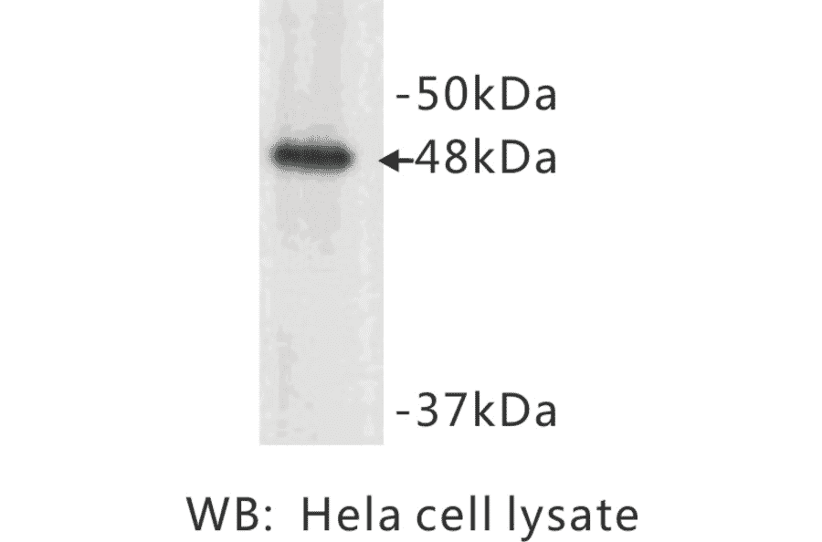 Western Blot - Anti-Cytokeratin 17 Antibody (BMA1015) - Antibodies.com