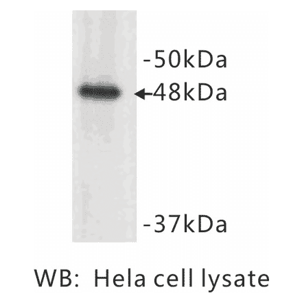 Western Blot - Anti-Cytokeratin 17 Antibody (BMA1015) - Antibodies.com