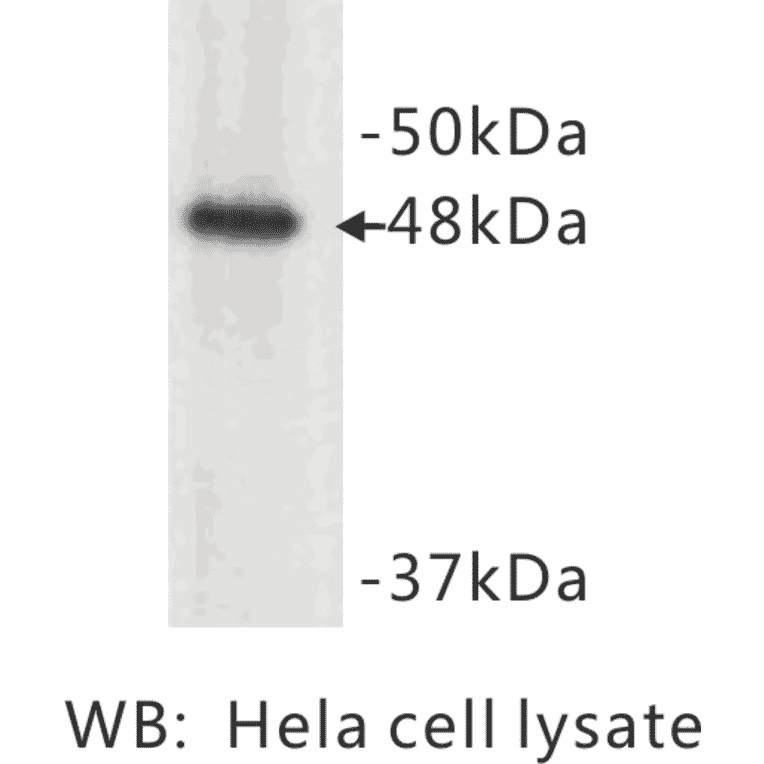 Western Blot - Anti-Cytokeratin 17 Antibody (BMA1015) - Antibodies.com