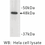 Western Blot - Anti-Cytokeratin 17 Antibody (BMA1015) - Antibodies.com