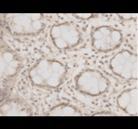 Immunohistochemistry - Anti-EPCAM Antibody (BMA1019) - Antibodies.com