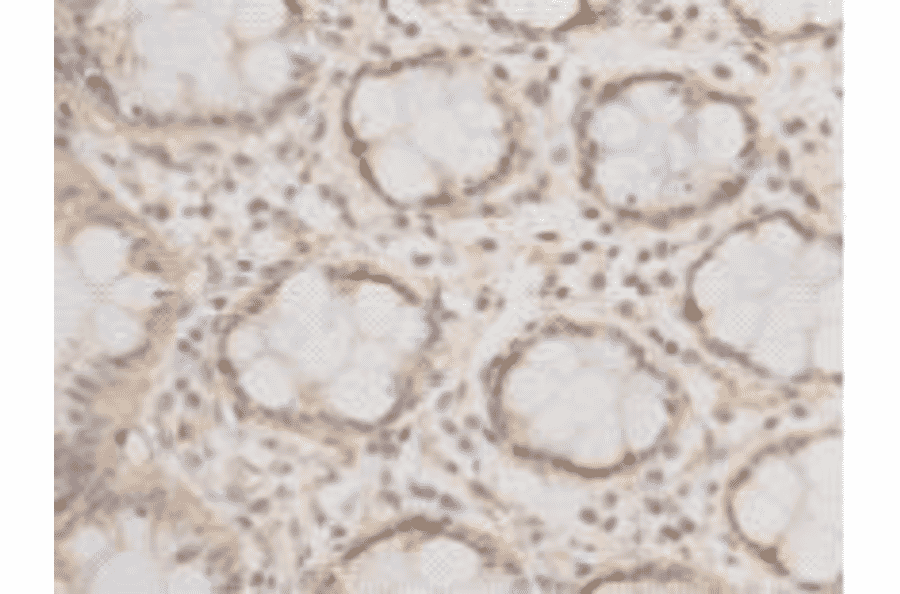 Immunohistochemistry - Anti-EPCAM Antibody (BMA1019) - Antibodies.com