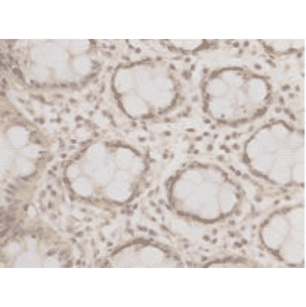 Immunohistochemistry - Anti-EPCAM Antibody (BMA1019) - Antibodies.com