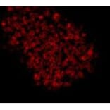 Immunocytochemistry - Anti-EPCAM Antibody (BMA1019) - Antibodies.com