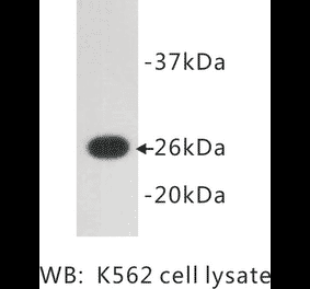 Western Blot - Anti-GFP Antibody (BMA1020) - Antibodies.com