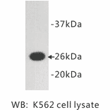 Western Blot - Anti-GFP Antibody (BMA1020) - Antibodies.com