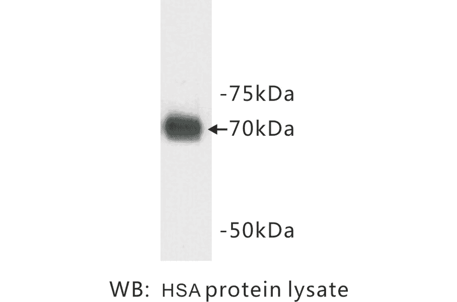 Western Blot - Anti-Human Serum Albumin Antibody (BMA1024) - Antibodies.com