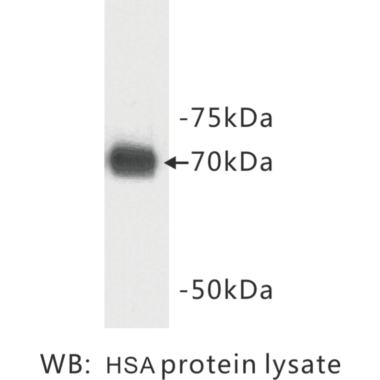 Western Blot - Anti-Human Serum Albumin Antibody (BMA1024) - Antibodies.com