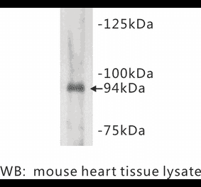 Western Blot - Anti-Junctophilin 2 Antibody (BMA1026) - Antibodies.com