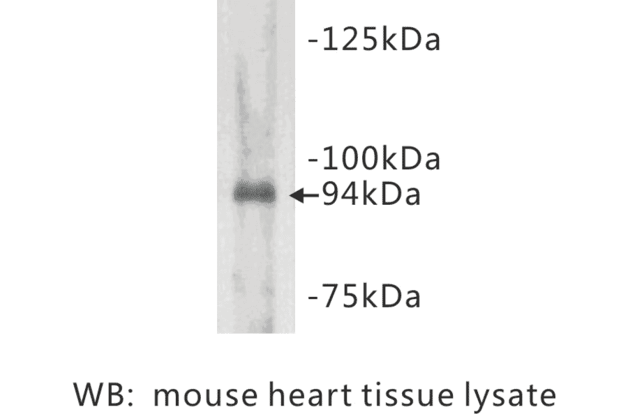 Western Blot - Anti-Junctophilin 2 Antibody (BMA1026) - Antibodies.com