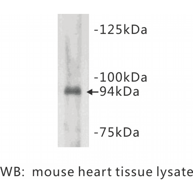 Western Blot - Anti-Junctophilin 2 Antibody (BMA1026) - Antibodies.com