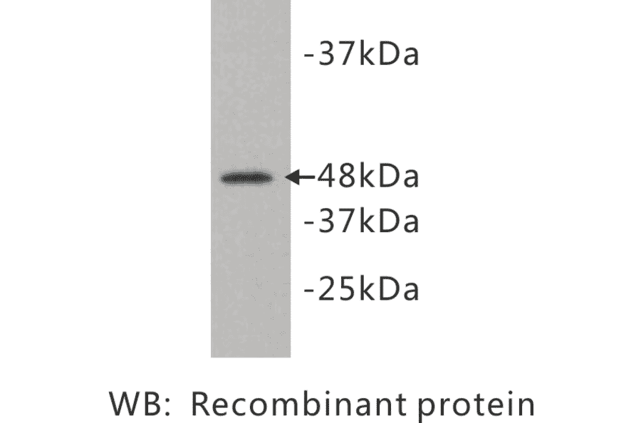 Western Blot - Anti-Kidins 220 Antibody (BMA1027) - Antibodies.com