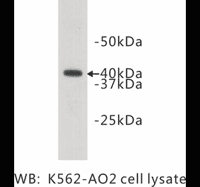 Western Blot - Anti-LASS2 Antibody (BMA1028) - Antibodies.com