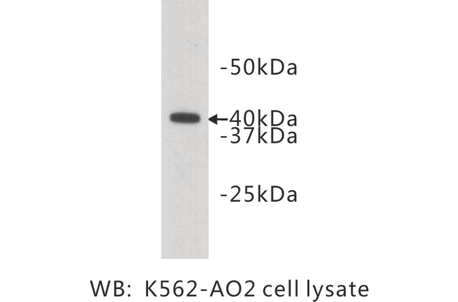 Western Blot - Anti-LASS2 Antibody (BMA1028) - Antibodies.com
