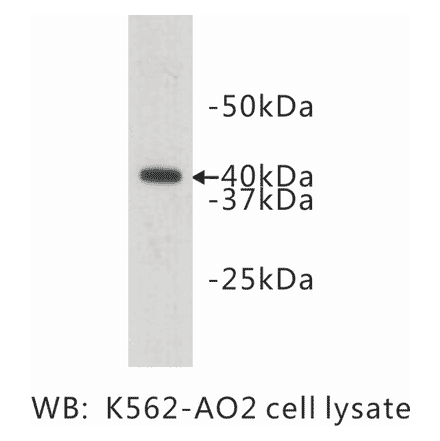 Western Blot - Anti-LASS2 Antibody (BMA1028) - Antibodies.com