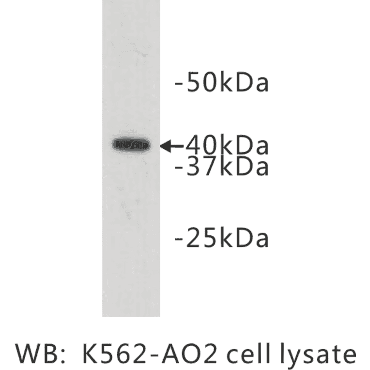 Western Blot - Anti-LASS2 Antibody (BMA1028) - Antibodies.com