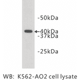 Western Blot - Anti-LASS2 Antibody (BMA1028) - Antibodies.com